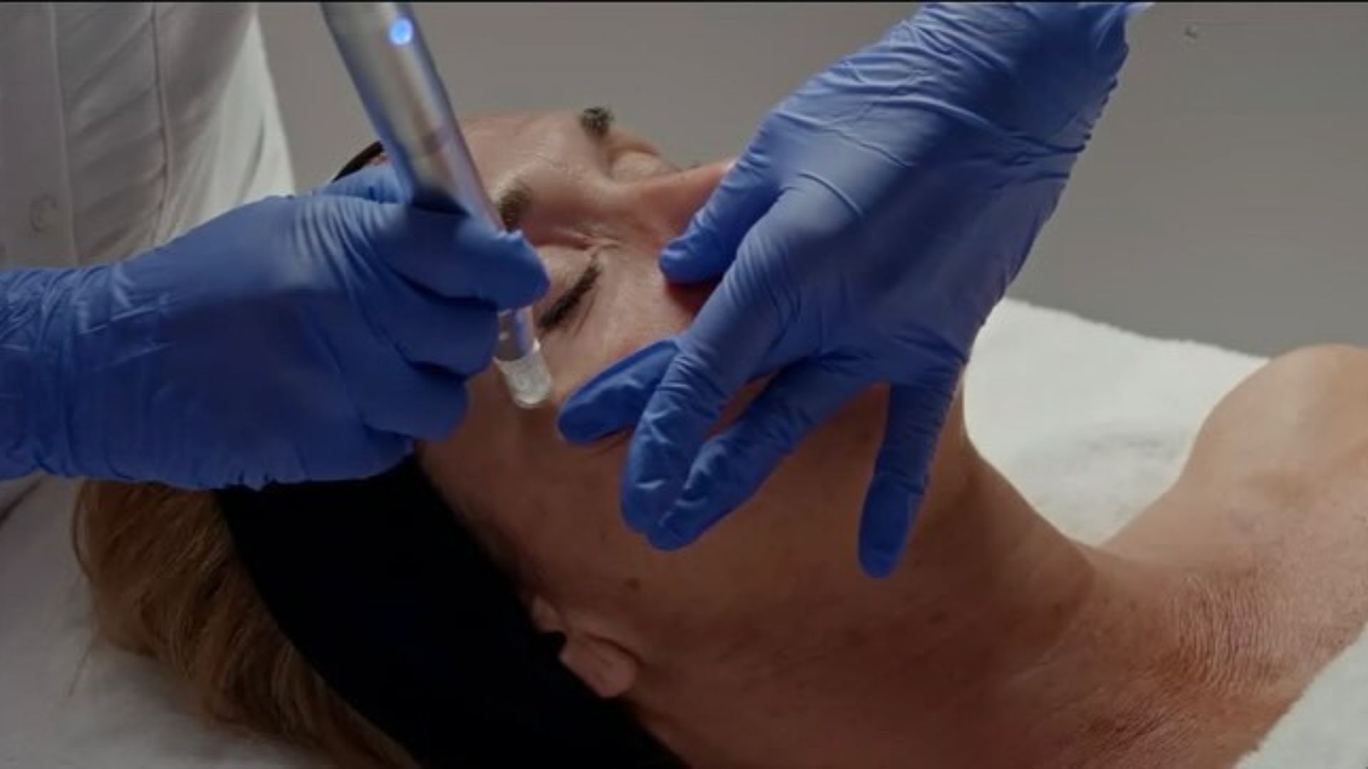 CURE RESURFACING OCULAIRE 4 SEANCES image